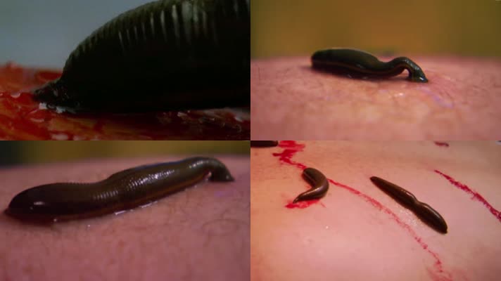 吸血水蛭吸血虫子害虫寄生视频素材