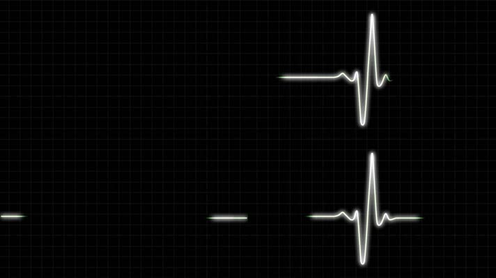 医疗信息 科技电子 素材视频 科技波动 心脏跳动舞台背景 死亡直线