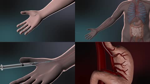 3D人体医疗胃部注射动画