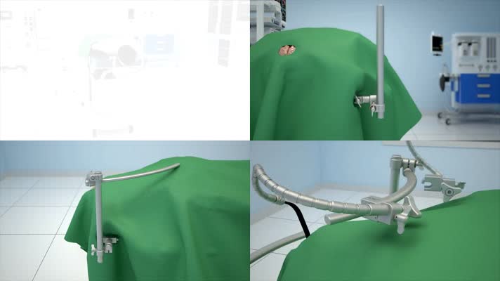 三维医疗脑部手术动画演示