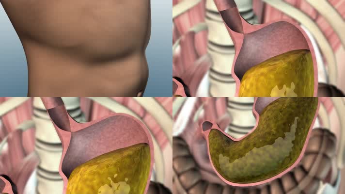 3D肠胃医疗视频