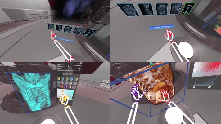 VRAR身体解剖观察虚拟现实医疗视频