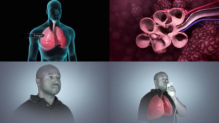 3D肺功能测试医疗视频