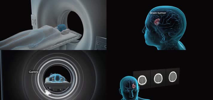 3DCT扫描医疗视频