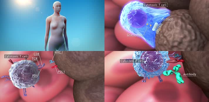 3D肿瘤免疫疗法医疗视频