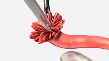 4K震撼3D医疗视频