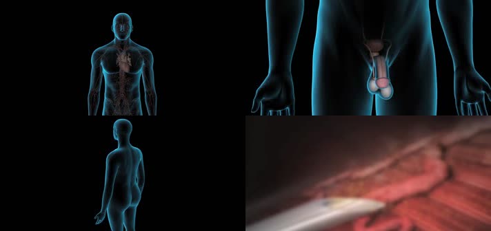 3D低睾酮性欲医疗视频