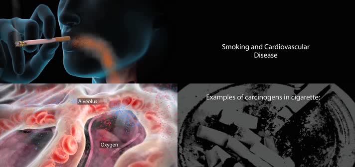 3D吸烟对婴儿健康危害医疗视频