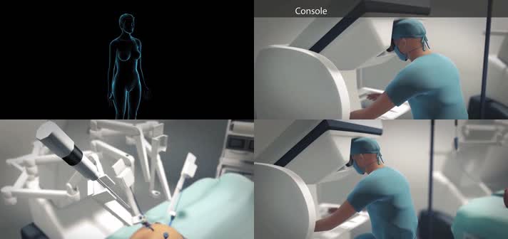 3D机器人手术医疗视频