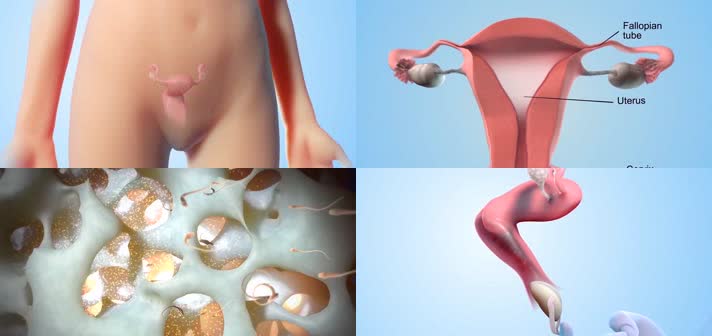 3D阴道避孕海绵医疗视频
