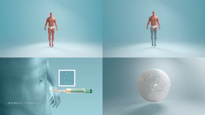 3D伤口愈合医疗动画