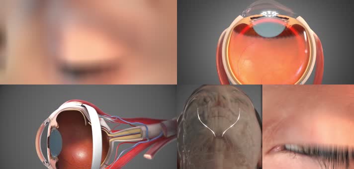  实拍视频 医疗教育 3D人体眼睛医疗手术动画演示