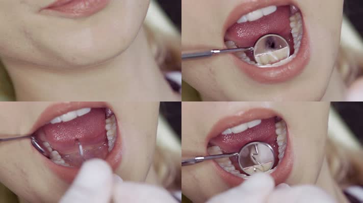 牙科 检测牙齿 牙医 牙痛  