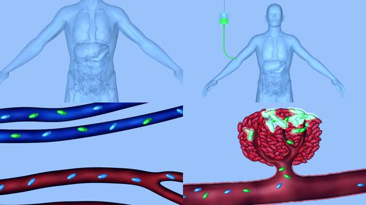 動脈 靜脈 血液 血液流動 血液素材 血管 血管堵塞 血管模型 血管動畫
