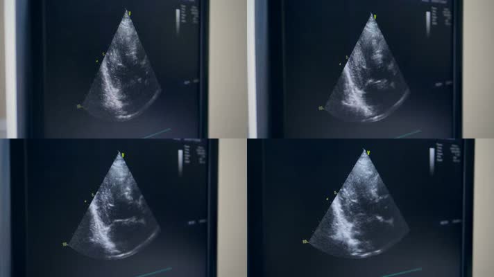 心电图 医院 扫描 x光 怀孕  