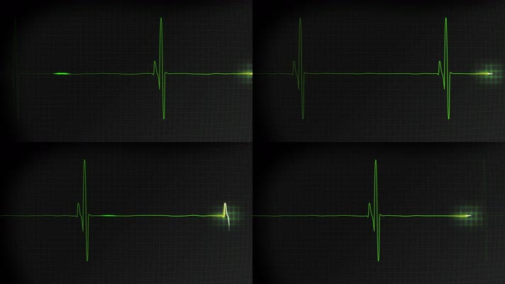 心跳 心率 医疗显示屏