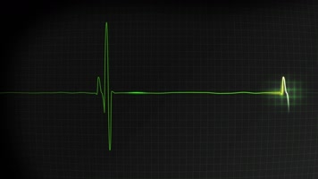 心跳 心率 医疗显示屏   心跳 心率 医疗显示屏