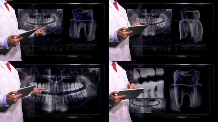 牙科医生虚拟屏幕分析研究牙齿疾病