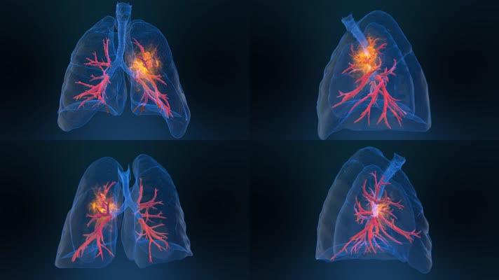 4K肺部虚拟成像透视图
