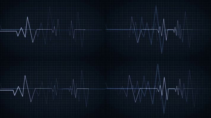 心电图脑电波曲线图折线图医疗科技背景