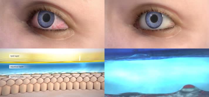 眼睛干燥症三维肌理动画2