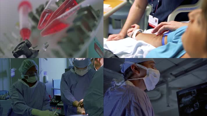 心脏外科手术扩张心脏血管医疗科技4K实拍