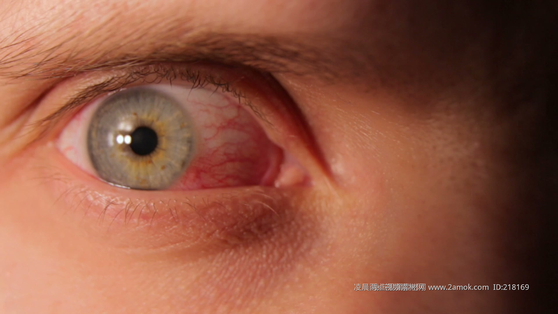 眼睛各类疾病图片素材-编号32455171-图行天下