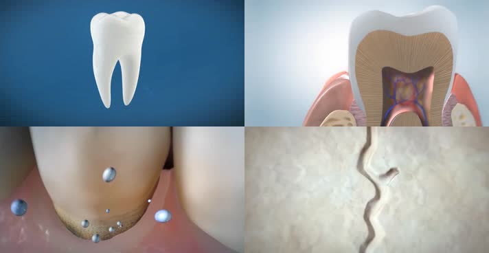 口腔牙齿护理牙痛龋齿原理背景视频