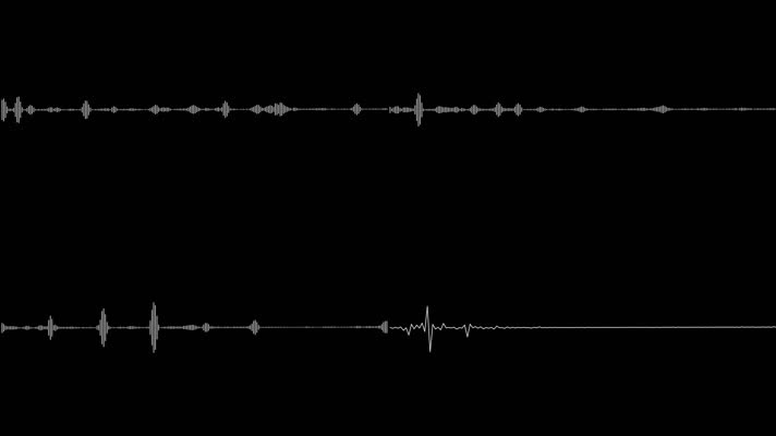 音波和心电图