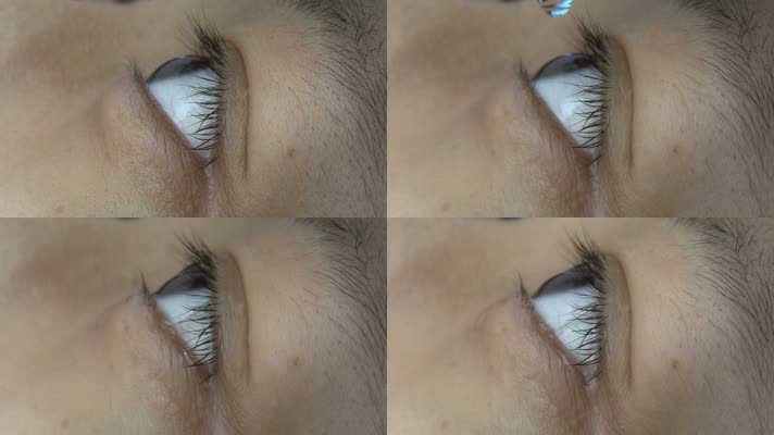 【原创】120帧慢动作滴眼药水