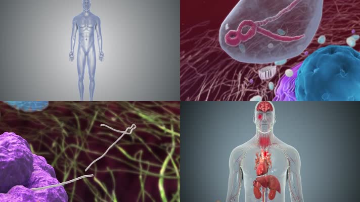 埃博拉病毒入侵人体组织发病机理医学动画