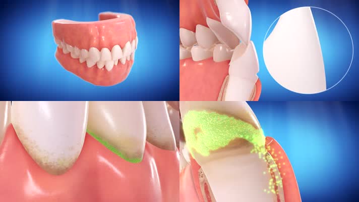 牙齿肌理医疗三维动画