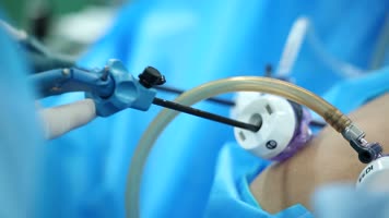 手术室设备抢救微创手术