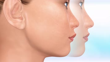 牙齿矫正牙龈矫正 牙齿矫正牙龈矫正