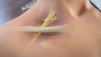 肩膀韧带修复 肩膀韧带修复