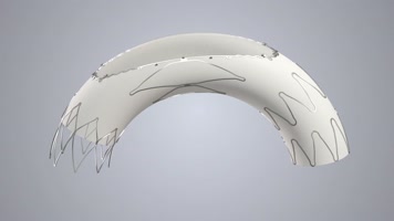 心脏血管支架 心脏血管支架