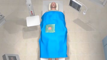 微导管三维动画 微导管三维动画