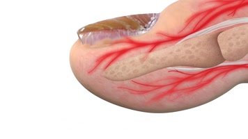 脚趾治疗灰指甲 脚趾治疗灰指甲