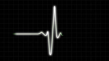 心脏脉搏监测心电图