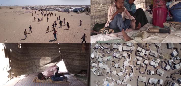 人道主义，反战人权，儿童残疾残废