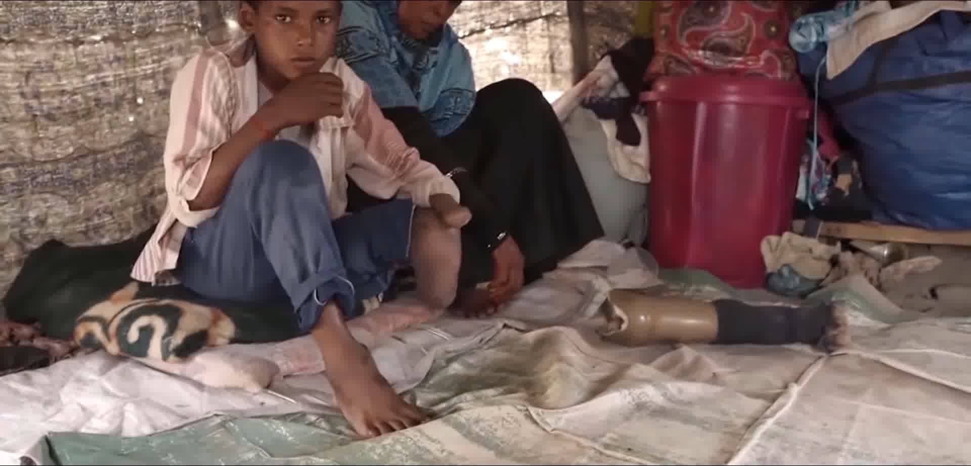 人道主义，反战人权，儿童残疾残废