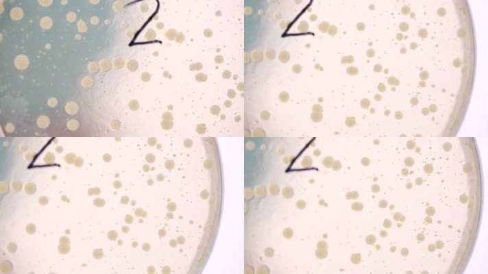 培养皿细菌培养实验菌群 (6)