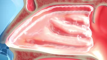 鼻腔内细菌滋生引发鼻炎