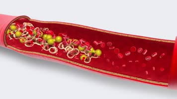 4k血液毒素造成血管堵塞 4k血液毒素造成血管堵塞