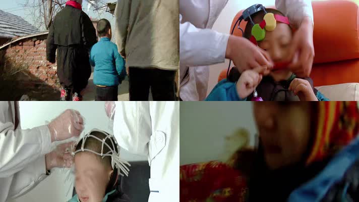 儿童抽动多动行为异常D