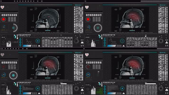 脑扫描x射线胶片与医学全息图在实验室科学