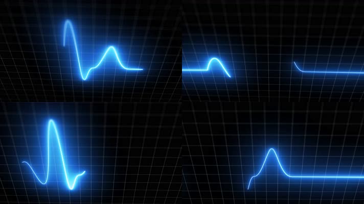 心电图心电图监护仪