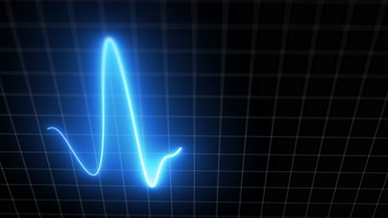 心电图心电图监护仪