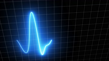 心跳监护仪心律