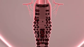 阴道褶皱滋生细菌妇科疾病